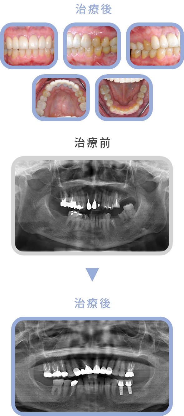 治療後